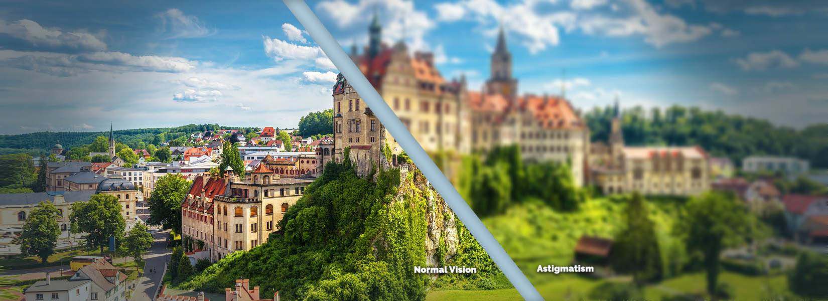 Astigmatism Treatment in Southlake