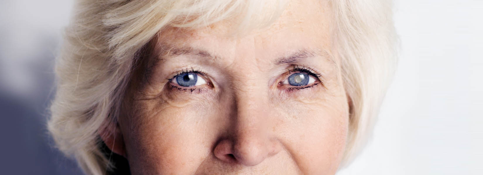 Cataract Surgery in Southlake